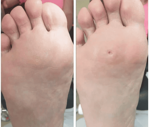 КОРЕЙСЬКА ЯКІСТЬ ПРОТИ МОЗОЛІВ